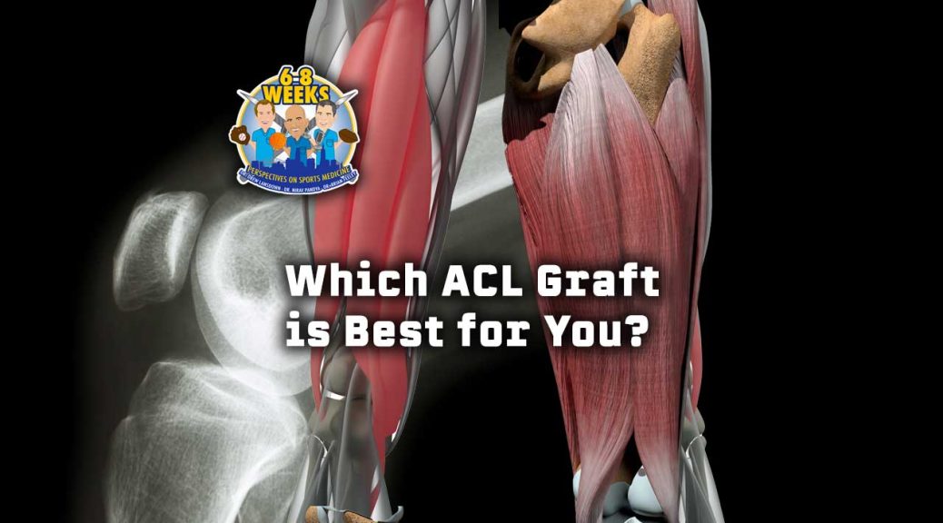 Patellas and Hamstrings and Quads, Oh My! Which ACL Graft is Best for You? 6 to 8 Weeks Podcast