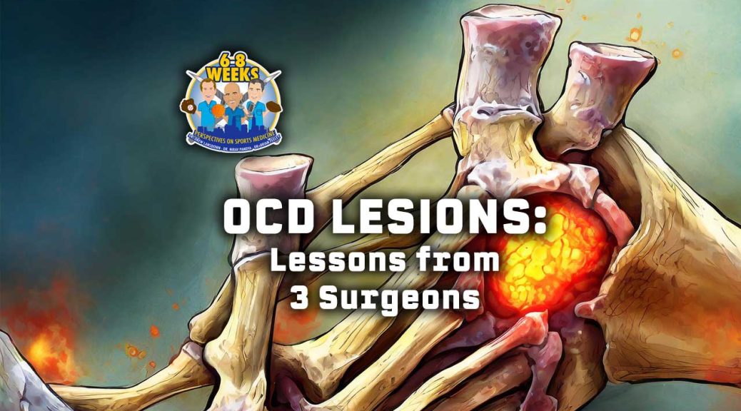 OCD Lesions - Lessons from 3 Surgeons: 6 to 8 Weeks Podcast
